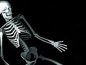 Skeleton